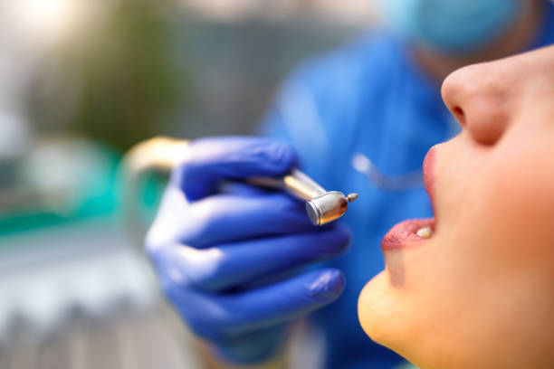 Best Wisdom Tooth Removal  in Dublin, CA